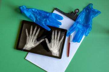 Medical Gloves And Hand X-Ray On Tablet With Clipboard And Pen On Green Background
