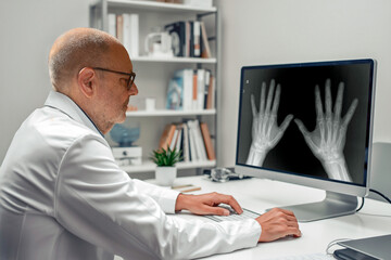 Medical Doctor Analyzing Hands X-Ray On Computer In Modern Clinic For Diagnostic Review