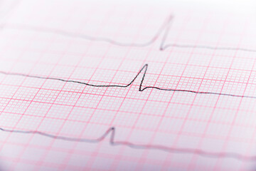 Health care background of Electrocardiogram plot