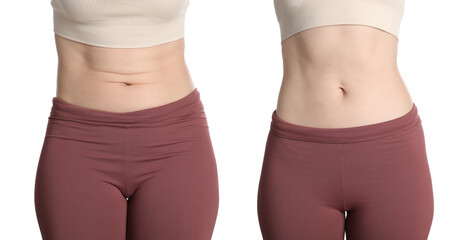 Before and after collage showing woman with good and bad posture against white background, closeup