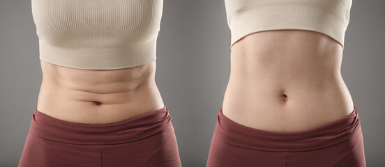 Before and after collage showing woman with good and bad posture against grey background, closeup