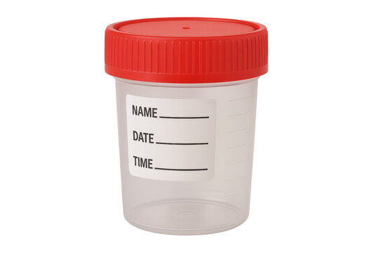 Clear medical specimen cup with red lid for testing