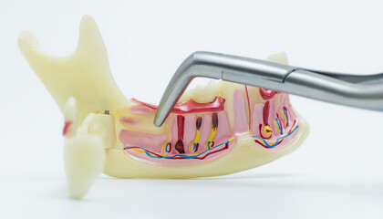 Dental Tool Pointing at Jawbone Anatomy Model