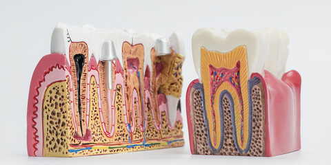 Comparative Tooth Cross-Section Models for Dental Education