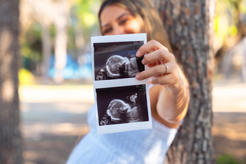 Happy pregnant woman holding ultrasound photo looking at camera outdoors in green park, concept of...