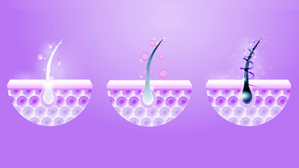 Hair Follicle Treatment and Growth Stages Illustration