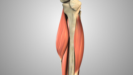 Malignant Soft Tissue Sarcoma in Leg