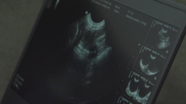 Veterinary ultrasound screen showing a dog's abdomen examination