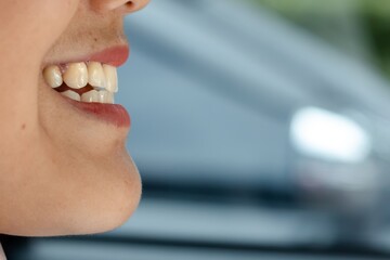 Close up shot of a young woman's teeth