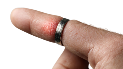 PNG of A close-up of a finger with a metallic ring, showing a slight red mark from removal.