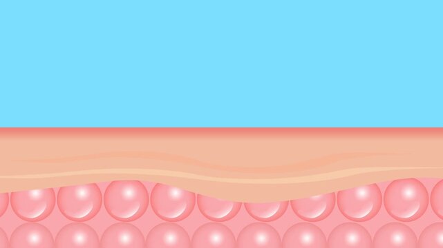 A 4K animation showing a cross-section of human skin layers and cells. A pimple, acne, or dandruff blockage forms and emerges. Ideal for cosmetic or medical ads.