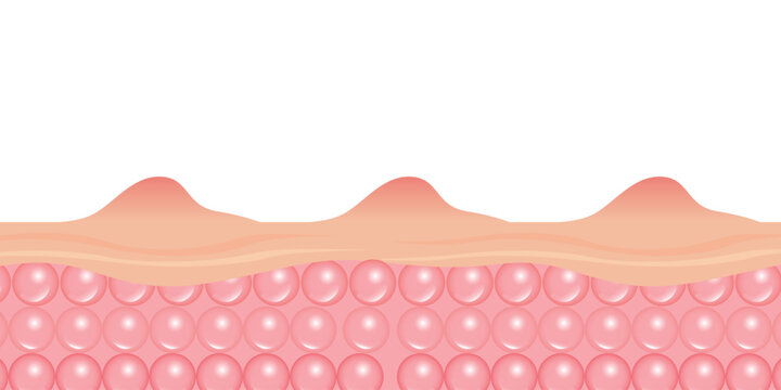 Detailed Human Skin Layers & Cells Vector Illustration. A scientific yet aesthetically pleasing cross-section of skin, revealing intricate layers and cells. Ideal for beauty product advertisements, 