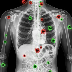 X-ray image of a human torso with virus-like graphics overlaid.