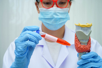 Doctor holding thyroid gland model and blood sample test tube in laboratory.