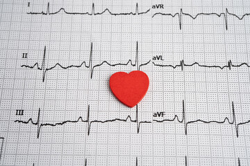 Electrocardiogram ECG, heart wave, heart attack, cardiogram report.