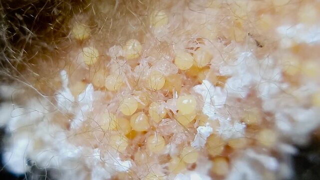 한국,거미,부화,새끼거미,알집,Korea, spider, baby spider, egg, incubation