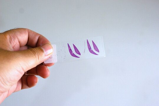 hand holding a glass microscope slide containing a purple-stained tissue sample on a light background