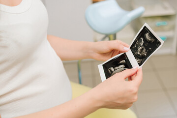Filming precious moments of motherhood with sonogram. Pregnant woman holds and looks at her baby ultrasound photo on her belly.
