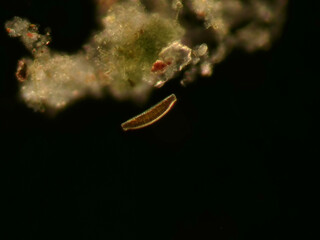 Cymbella sp. diatom under darkfield microscope at 10x 0.30 NA – detailed convex lateral view of freshwater microorganism