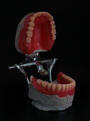 Removable dentures for complete adentia, cast in an accelador
