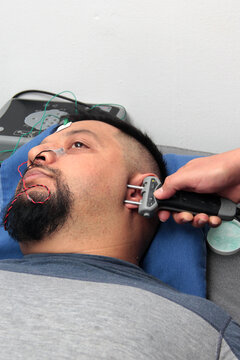 Electromyography EMG and facial nerve conduction velocity NCV to assess nerve damage from facial paralysis in a Latino male