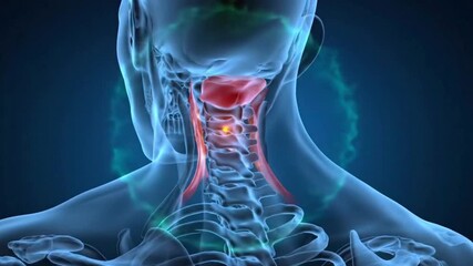 X ray view of human head and neck with highlighted pain areas and visible skull and spine anatomy