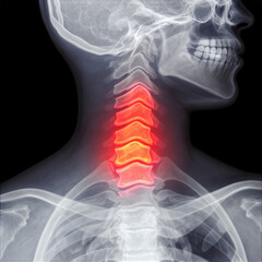 x ray image of human chest