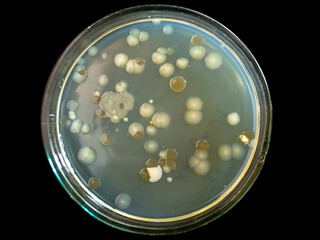 Petri dish with round colonies of bacteria of different sizes and colors, Petri dish on a black background.
