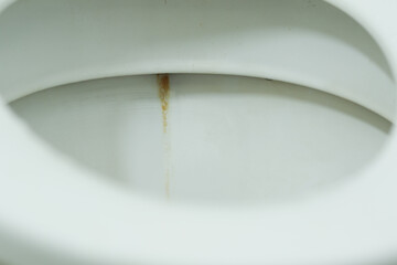 Dirt and rust stain the toilet bowl