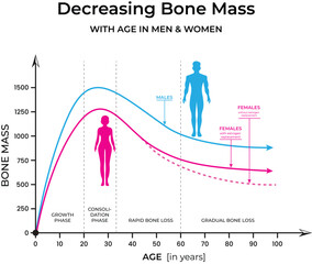 Bone Mass Decline with Age in Men and Women Vector Illustration inforgraphic