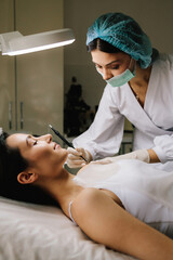 Dermatologist performs precise radio wave mole removal using radiofrequency surgery. Close-up of radio wave dermatologic mole excision. Radiofrequency mole removal under clinical conditions.