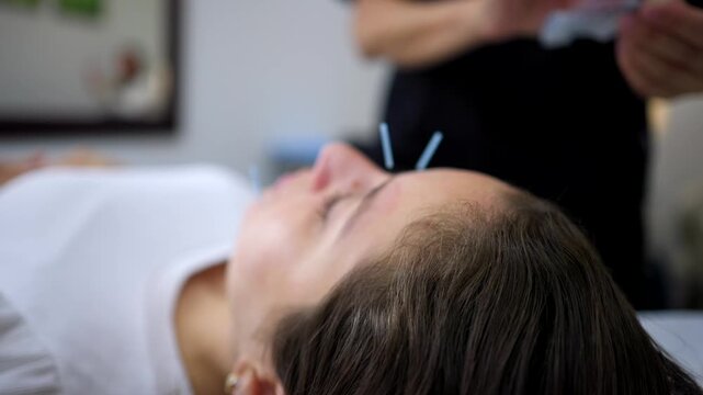 Close up of a relaxed woman undergoing a facial acupuncture procedure with a professional therapist inserting fine needles into her skin for rejuvenation and wellness in a health clinic
