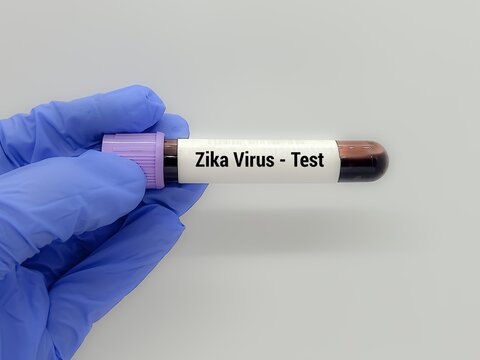 Doctor  holding a test blood sample for  Zika Virus - test. Laboratory medical testing concept.