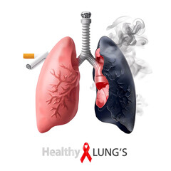 Smoking vs Healthy Lungs Comparison – Health Awareness Poster