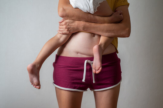 Anonymous Woman with a scar from a cesarean section holds a child