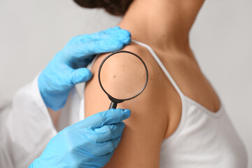 Dermatologist with magnifying glass examining moles of young woman on white background, closeup
