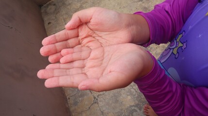 Child's hands are wrinkled after being exposed to water for a long time, close-up view.