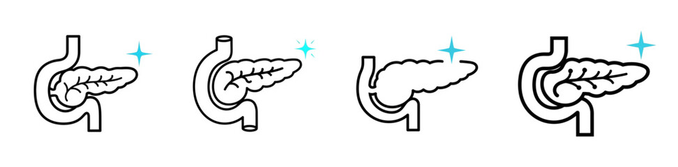 Medical illustration of the pancreas and surrounding organs, highlighting the organ's location and structure.