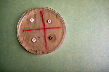 Petri Dish with Bacterial Culture and Antibiotic Discs