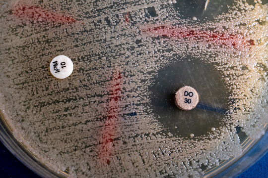 Bacterial Susceptibility Testing via Kirby-Bauer Disk Diffusion Assay