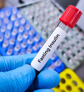 Blood sample for Fasting Insulin test used to detect insulin resistance. OGTT. Glucose Challenge test.