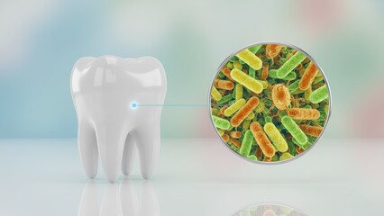A white tooth with magnified bacteria showing buildup and early infection linked to tooth decay or sensitivity in a clean medical view