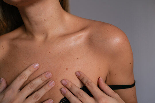 Close-up of young woman&rsquo;s chest and collarbone with lots of natural moles on a light grey background. Soft skin texture and gentle touch, symbol of body positivity, self-acceptance and natural beauty