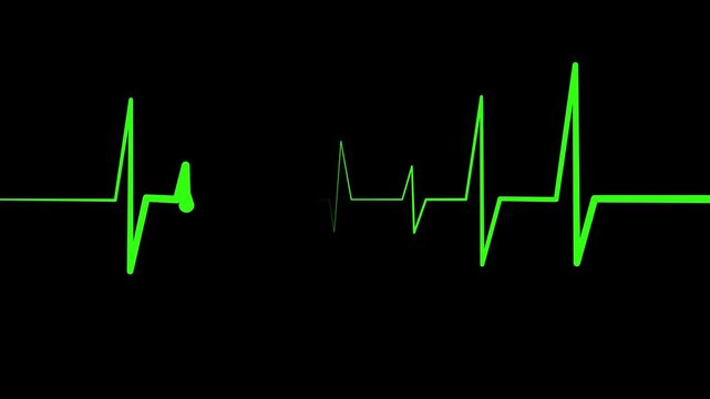 Heartbeat Line Wave Signal Animation with Continuous Pulse and Medical Monitoring