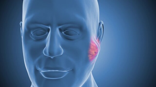 Human Salivary Gland Neoplasm Development