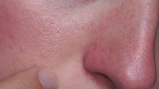 Macro close-up of woman touching her nose skin and pores. Concept of skincare, blackhead removal, dermatology, healthy skin texture and facial care routine for clean beauty.