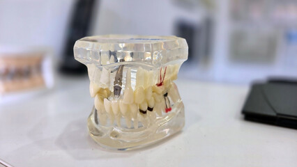 Dental clinic workspace with tooth model for oral health education and patient consultation. Horizontal banner. Copy space. Close-up