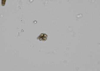 soil microorganisms under a microscope including amoeba, flagellates, nematodes, fungi, bacteria	
