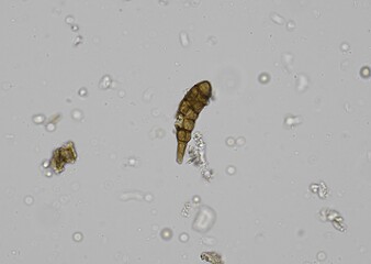 soil microorganisms under a microscope including amoeba, flagellates, nematodes, fungi, bacteria	
