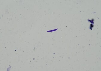 soil microorganisms under a microscope including amoeba, flagellates, nematodes, fungi, bacteria	
